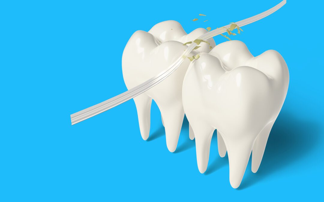 What Happens to Your Teeth When You Don’t Floss